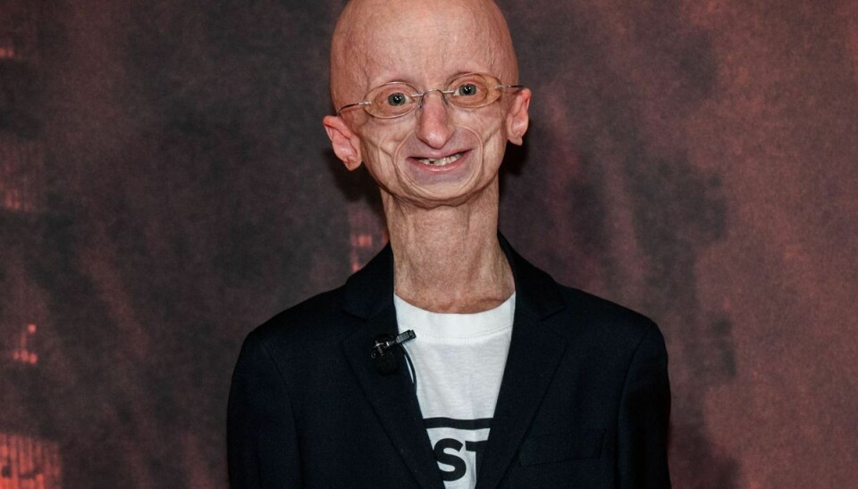 Jesper Sørensen ser ikke ligefrem frem til at få kanel af sine venner, når han fylder 25 år. Jesper Sørensen ser ikke ligefrem frem til at få kanel af sine venner, når han fylder 25 år.