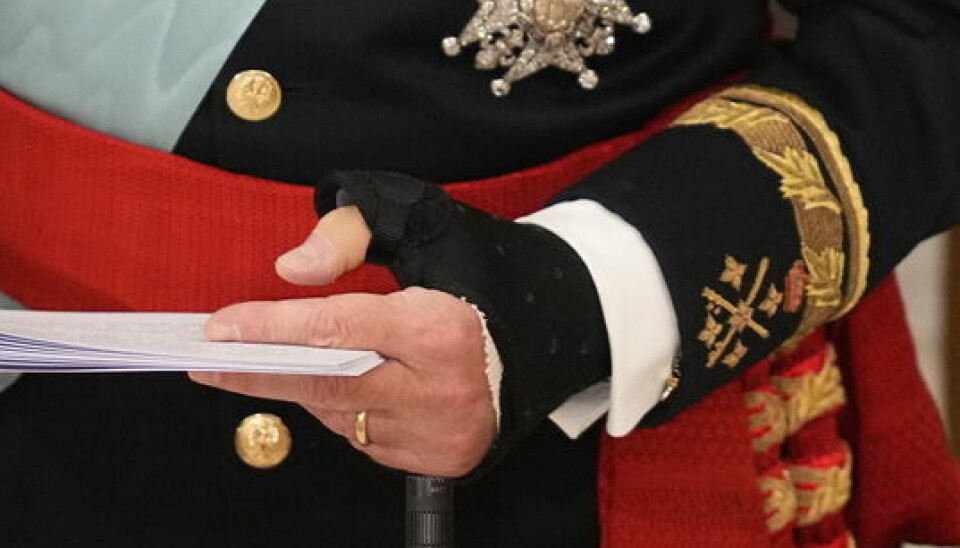 Kong Felipe er nødt til at bære en skinne for at forebygge betændelse i en sene.