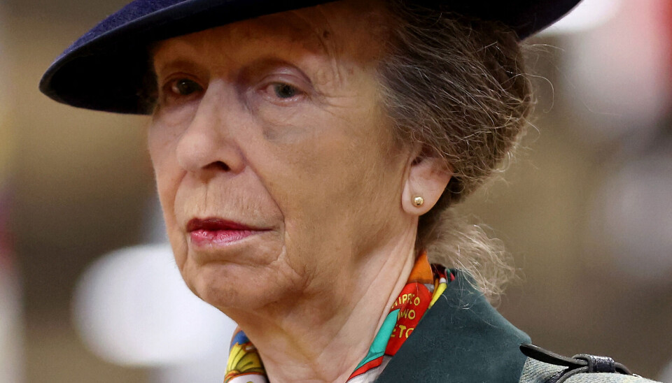 Prinsesse Anne med blåt øje efter styrt fra hesteryg.
