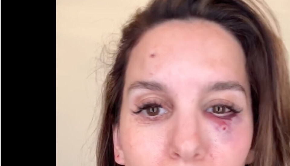 Christy Carlson Romano fortæller om episoden på Instagram.