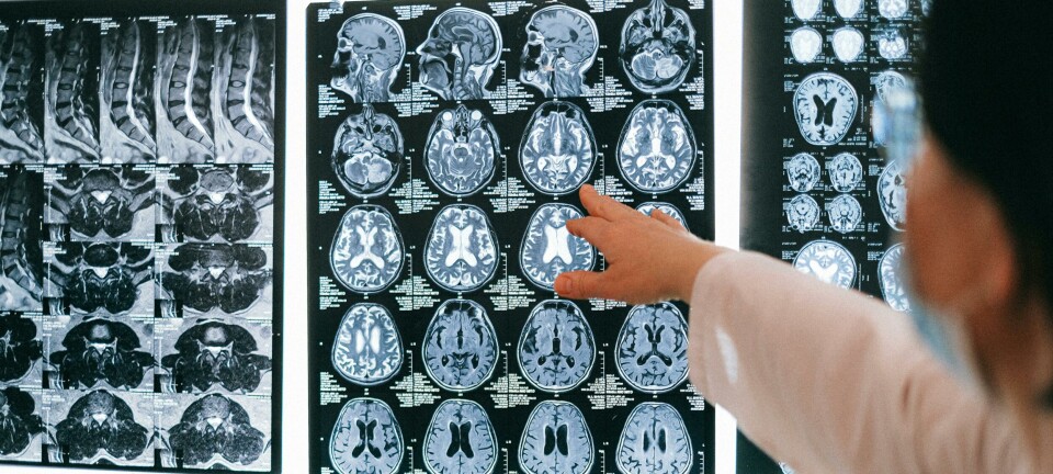 Afslører: Bremser hjernens aldring