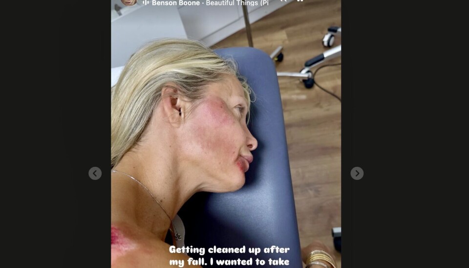 Så galt så det ud efter ulykken med Caroline Fleming