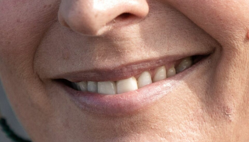 Kan du kende dem på smilet?